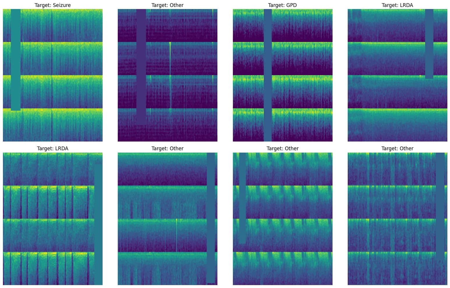 EEG spectrograms by class